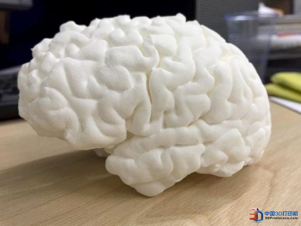 未來醫(yī)療行業(yè) 3D打印技術(shù)融入其中的四種方式

3D醫(yī)療行業(yè),3D打印心臟,3D打印大腦,3D打印應(yīng)用,3D打印領(lǐng)域,3D打印和醫(yī)療的關(guān)系,3D打印平臺(tái),3D打印服務(wù),3d打印企業(yè)服務(wù)平臺(tái)