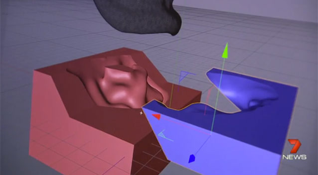 3d打印假耳 助力耳朵傷殘兒童恢復(fù)聽(tīng)力
3D打印耳朵,3D打印假耳,上海3d打印店,上海3d打印公司,上海3d打印展覽會(huì),上海3d打印展,上海3d打印園區(qū),上海3d打印專(zhuān)用瞬間膠jls020,上海3d打印樓房,上海3d打印企業(yè),上海3d打印展會(huì),上海3d打印展覽,上海3D打印