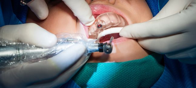 Formlabs創(chuàng)舉 生物相容性3D打印樹脂Dental SG誕生記

3d打印樹脂,3d打印樹脂材料,3d打印材料有哪些,3d打印材料價格,3d打印耗材,大連3d打印,大連3d打印機,大連3d打印公司