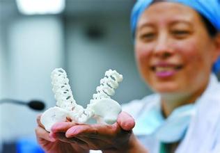 世界首例醫(yī)療3D打印應用案例 3D打印假體骶椎成功植入